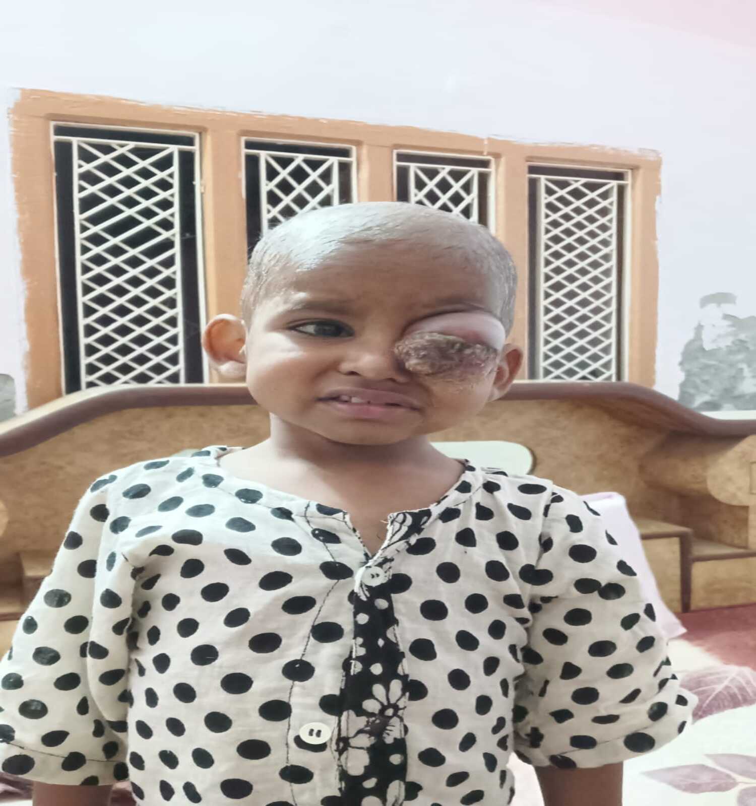 Help Geetika Fight Eye Cancer
